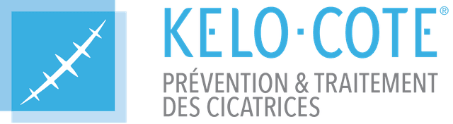 Kelo-cote